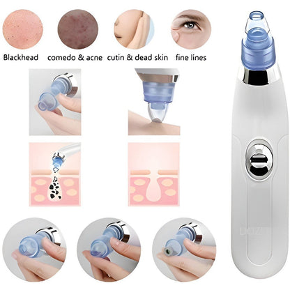DermaSuction Pro – Deep Pore Blackhead Remover (Original)