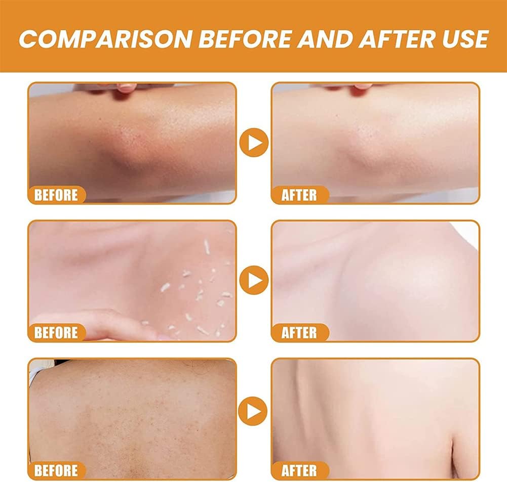 Orange Whitening Exfoliating Brightening Gel