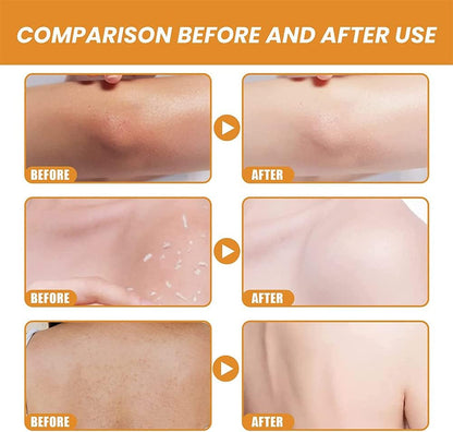 Orange Whitening Exfoliating Brightening Gel