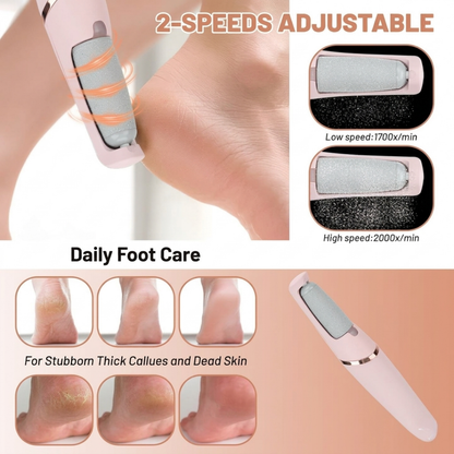 Electric Foot Callus Remover – Rechargeable Pedicure Tool